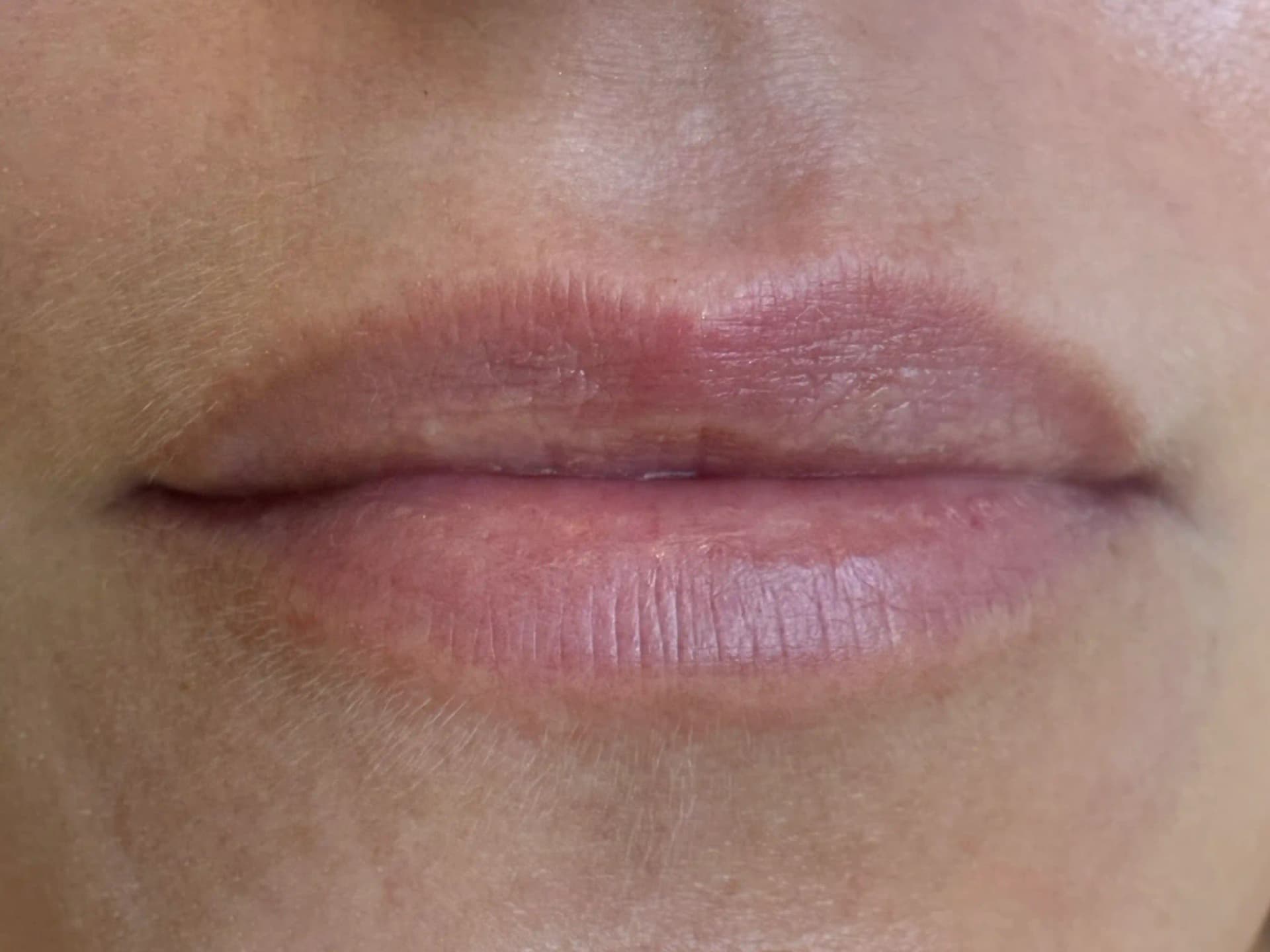 Vorher – Aquarell Lips