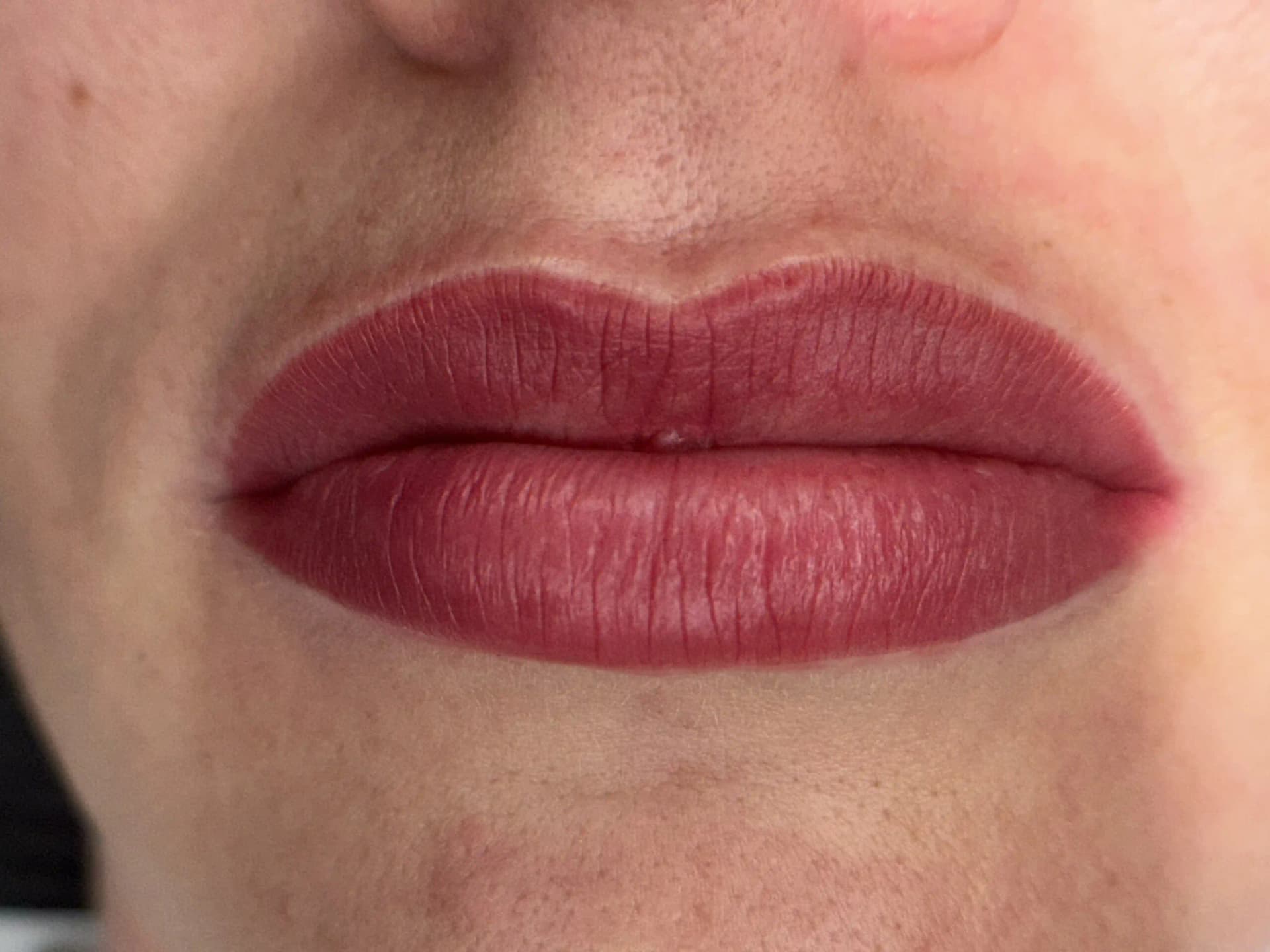 Nachher – Sensual Lips