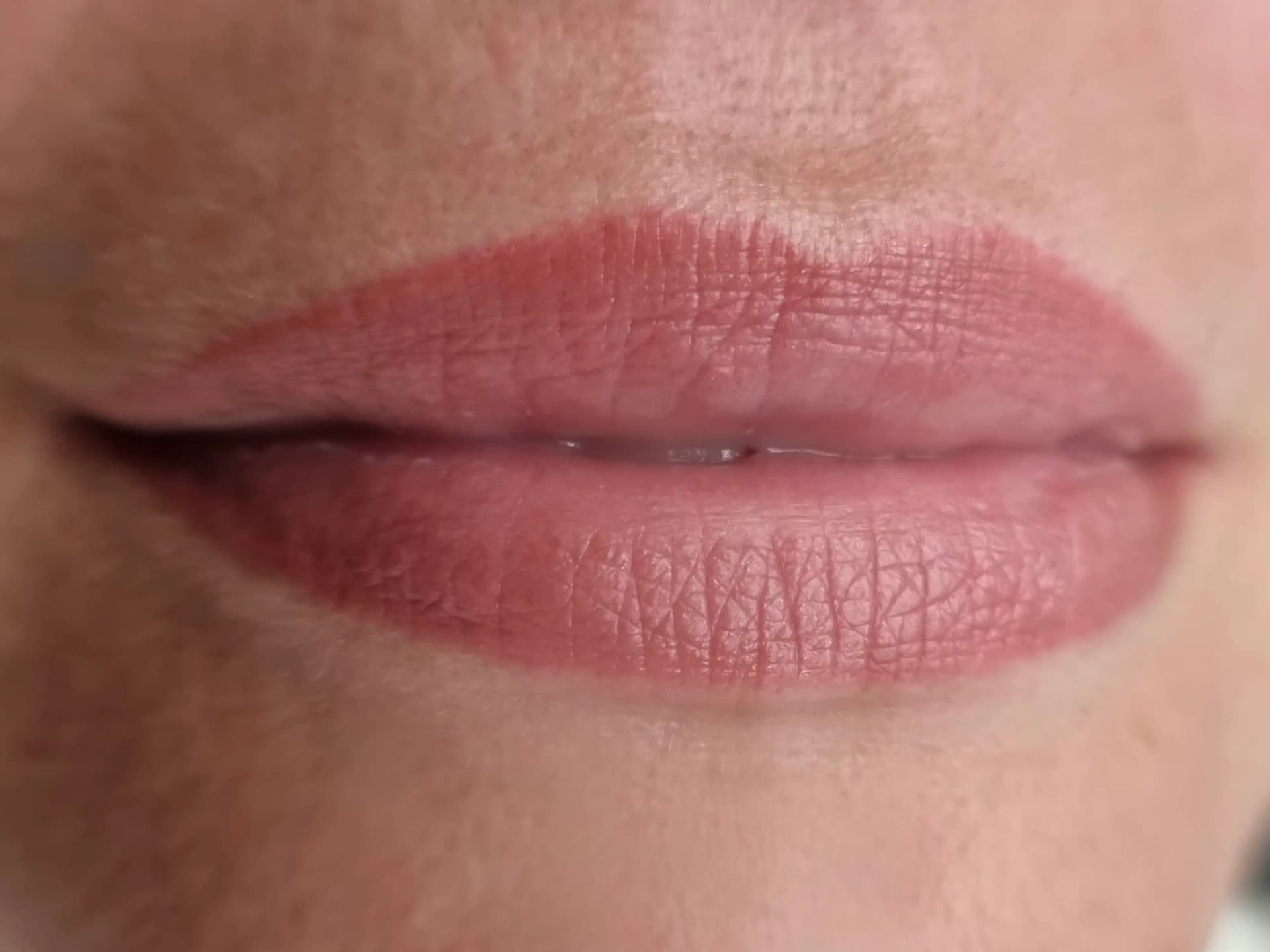 Nachher – Lippenpigmentierung