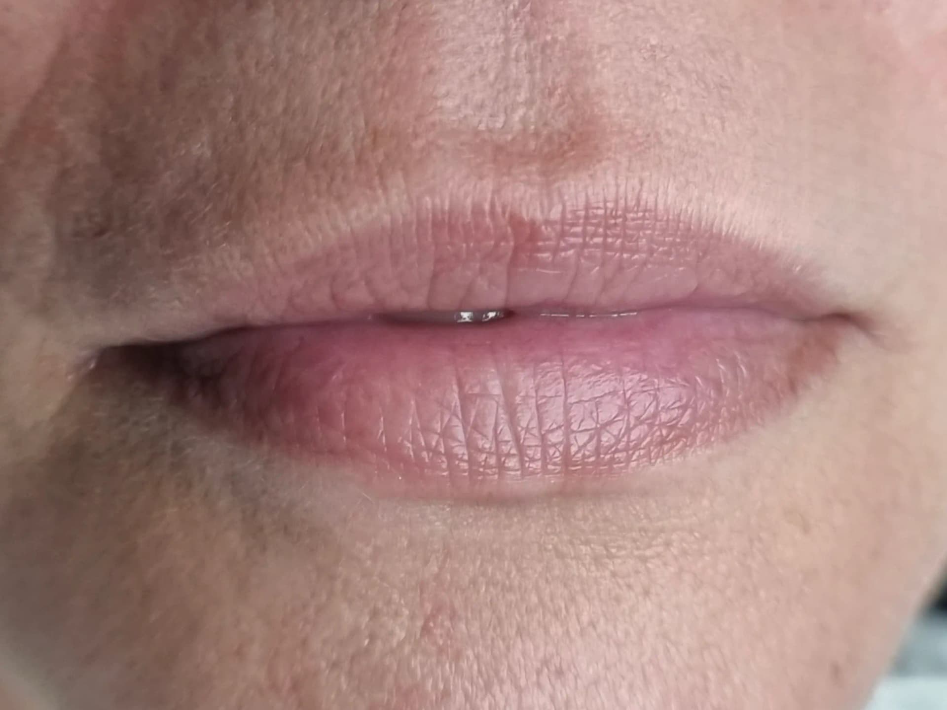 Vorher – Lippenpigmentierung