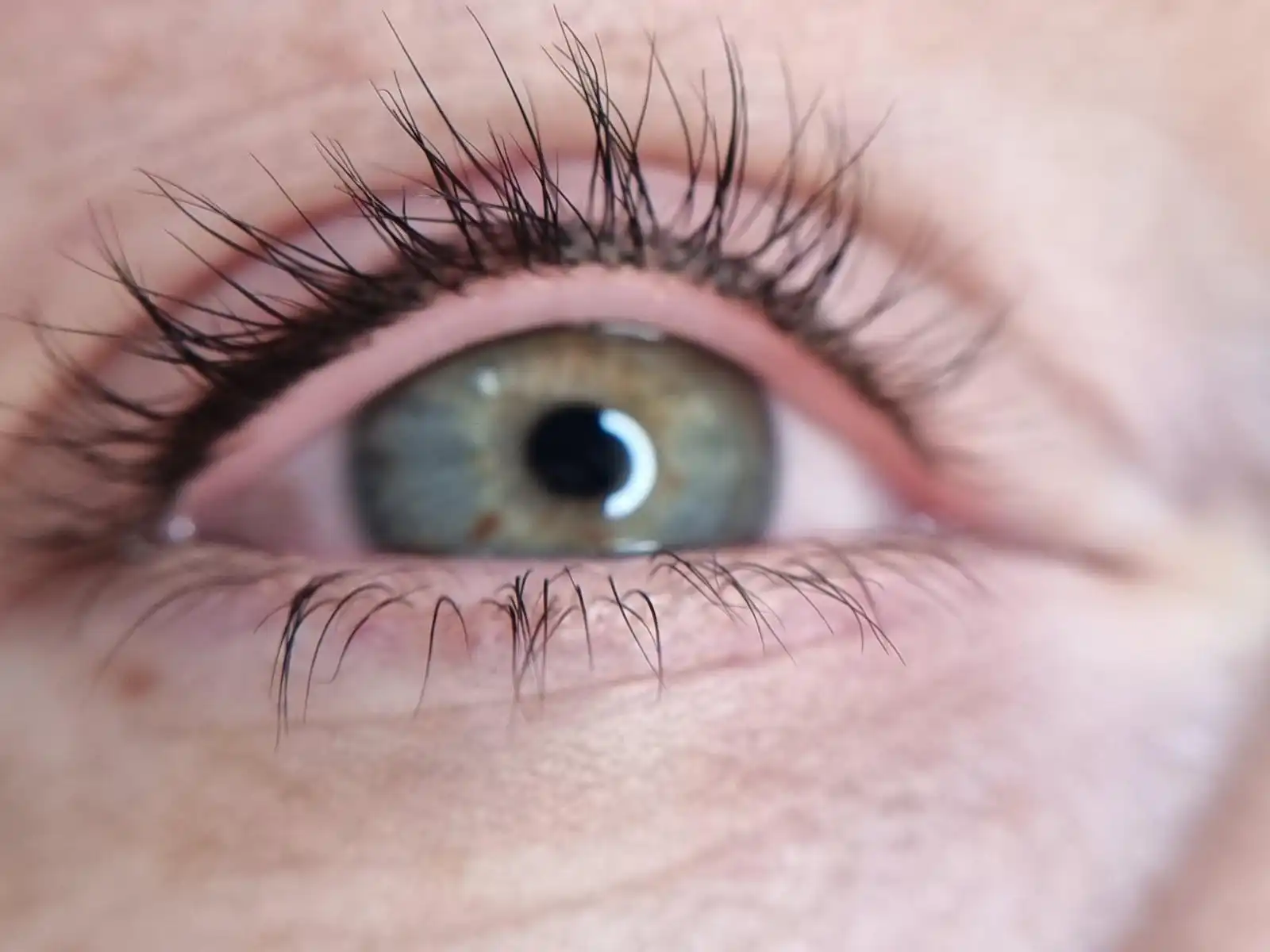 Nachher – Wimpernkranzverdichtung