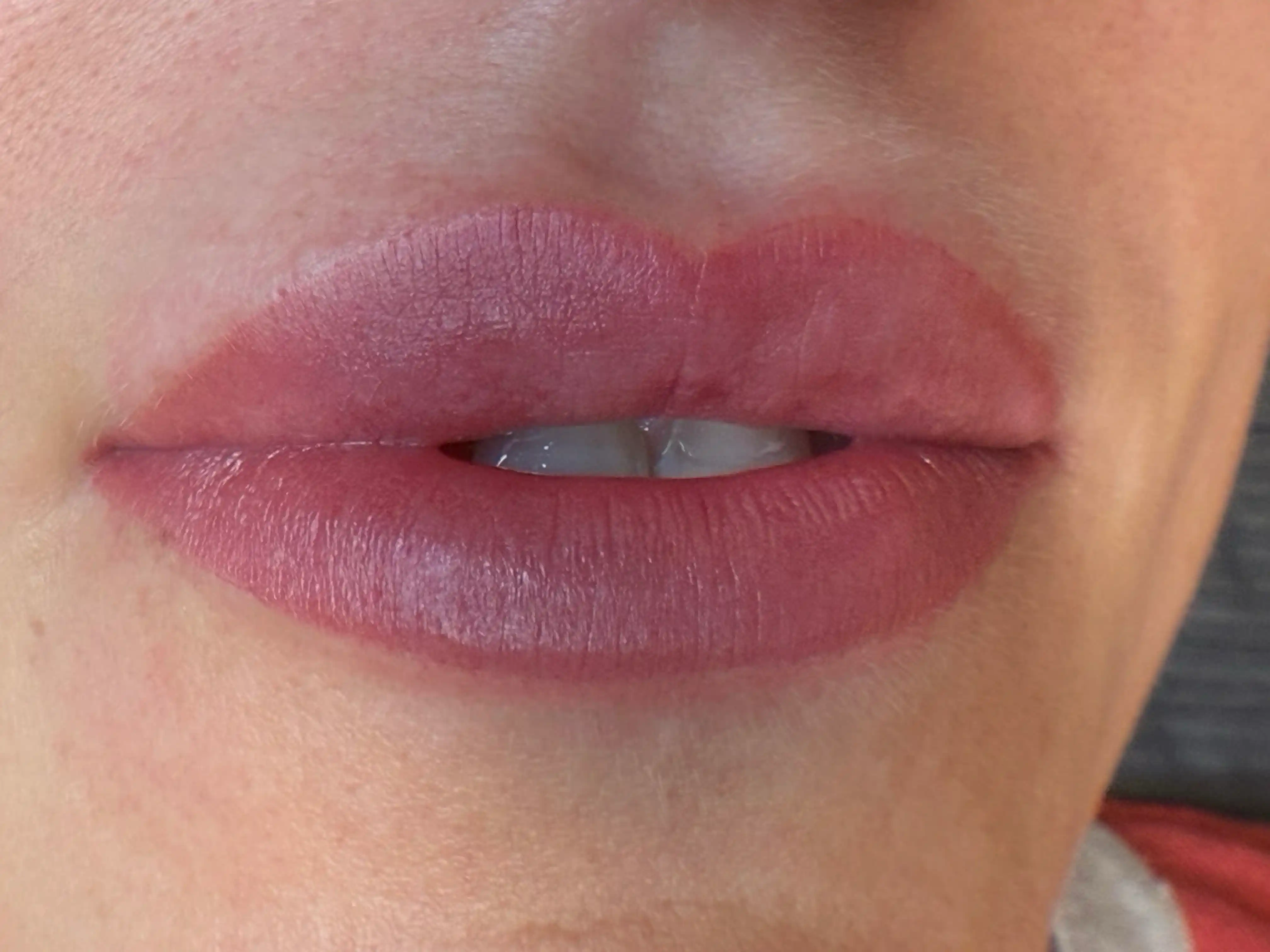 Vorher – Sensual Lips